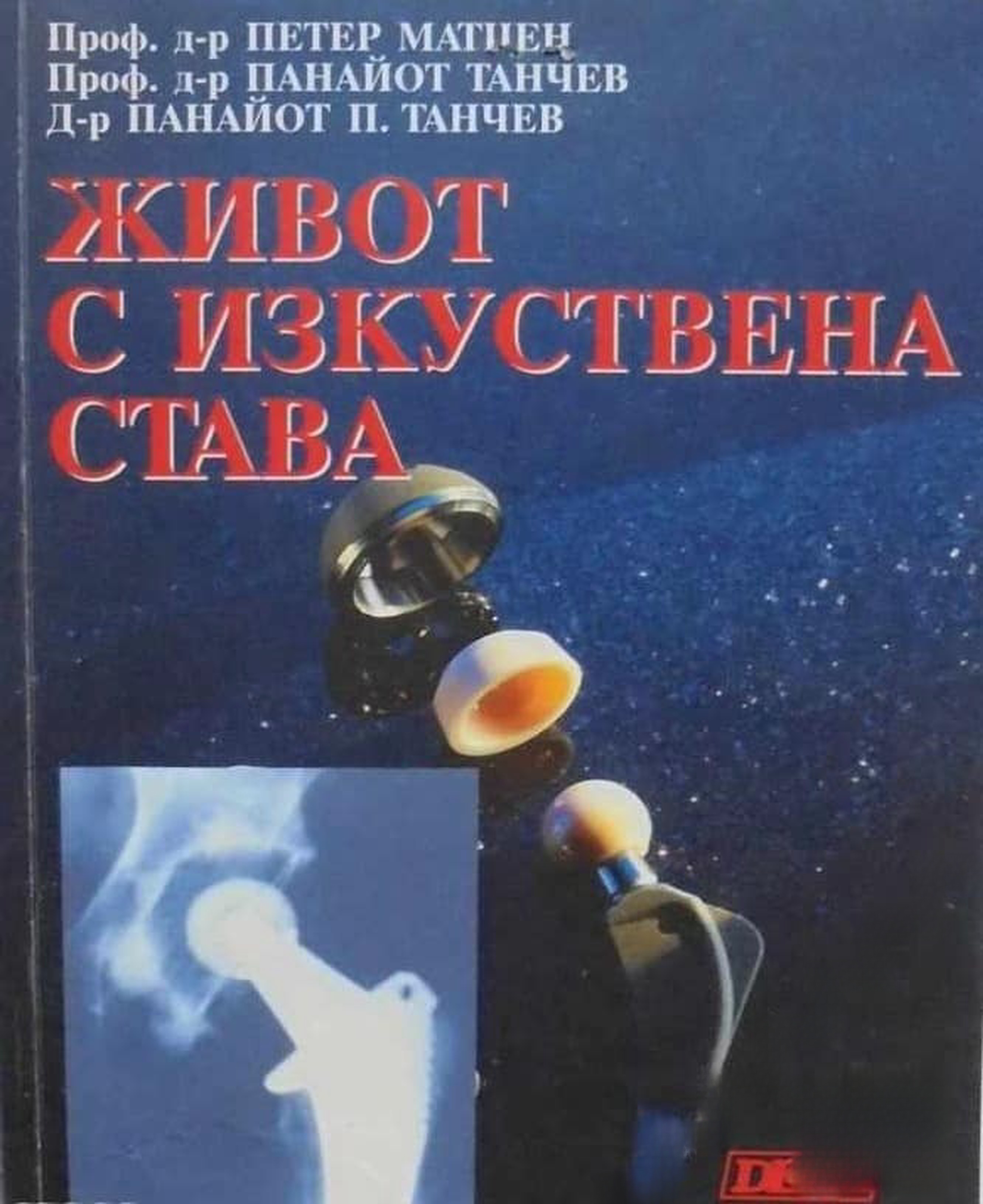 Живот с изкуствена става — cover